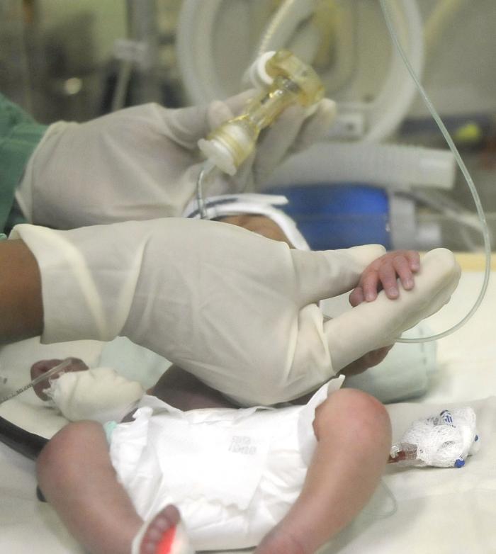 Nuevo aporte para el diagnóstico neonatal con tecnología SUMA